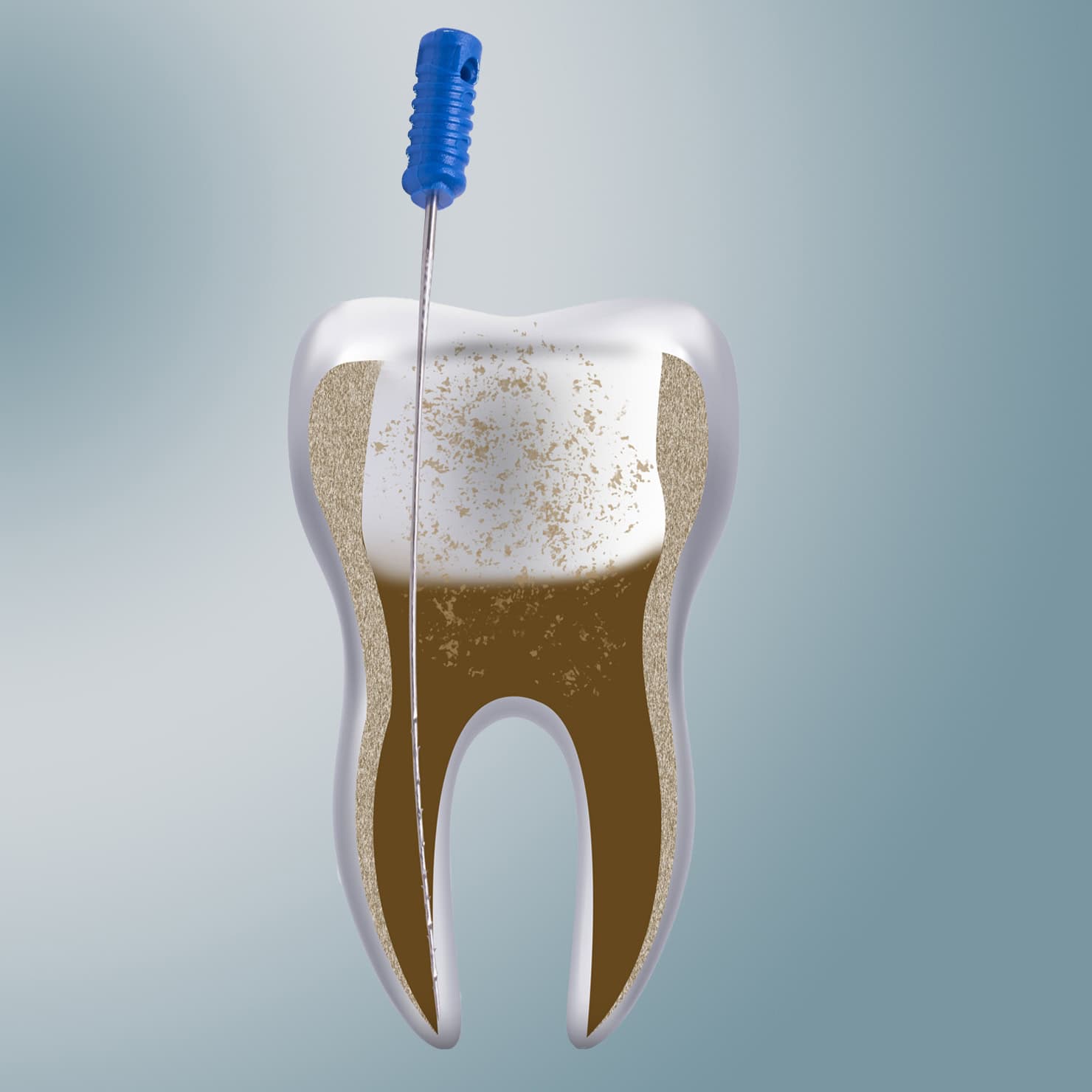 procedure